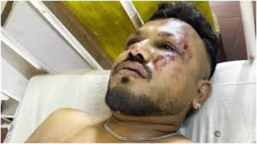 বিমান বিধ্বস্তে অলৌকিকভাবে বেঁচে গেলেন এক যুবক