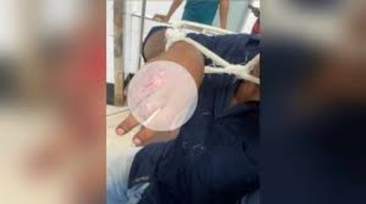 সাভারে বসা নিয়ে বিরোধ, কুড়ালের আঘাতে যুবক গুরুতর আহত